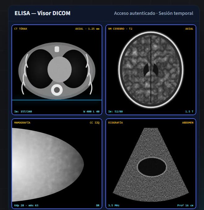 Visor DICOM web con estudios de tomografía, resonancia, mamografía y ecografía